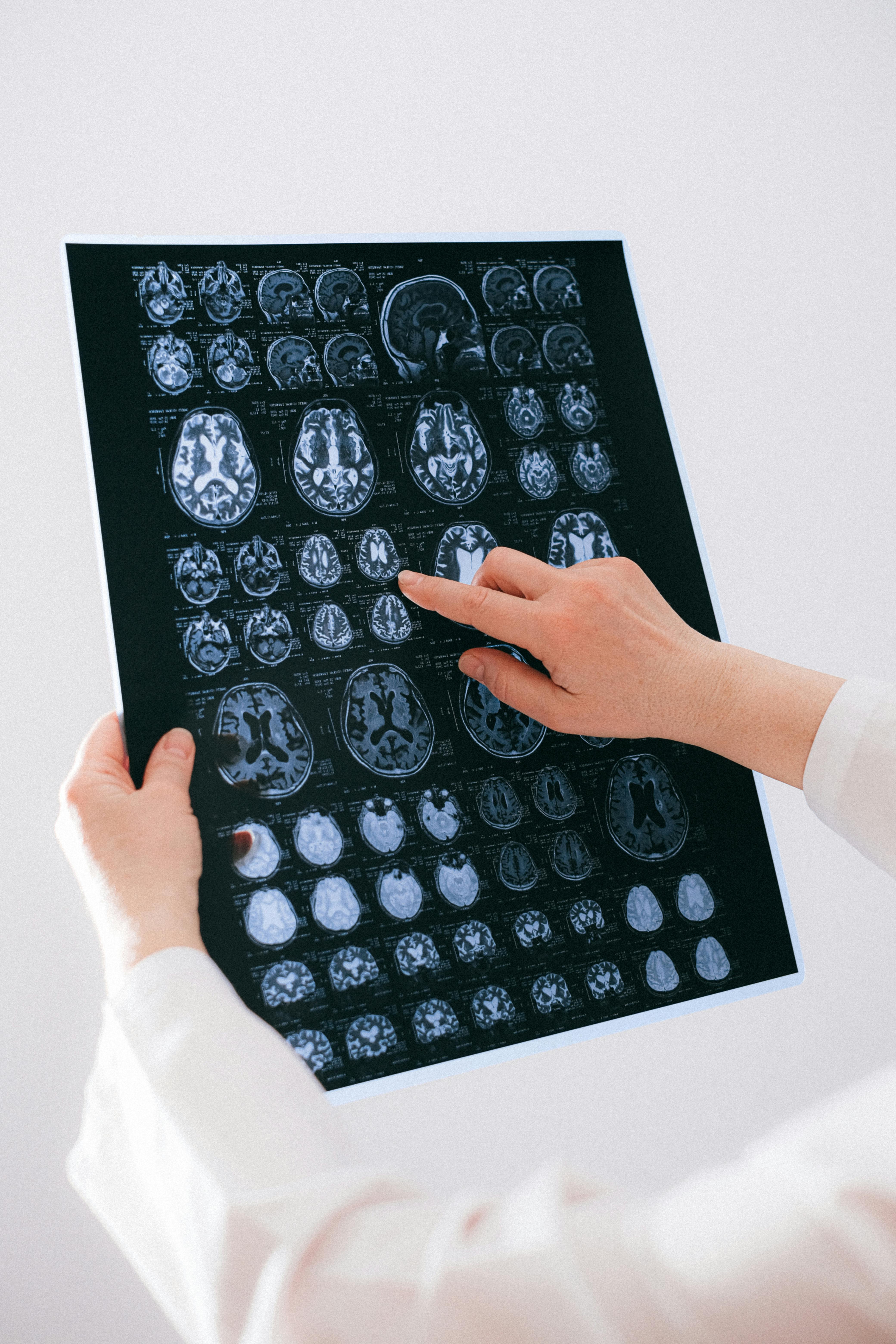 Medical professional reviewing brain CT scan images